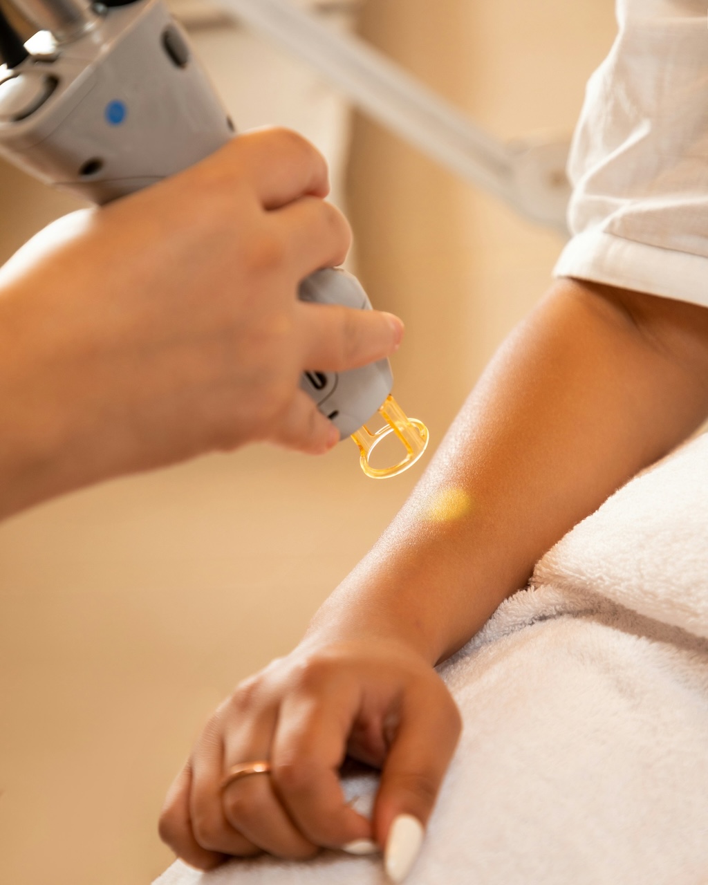 Laserbehandlung am Unterarm einer Patientin